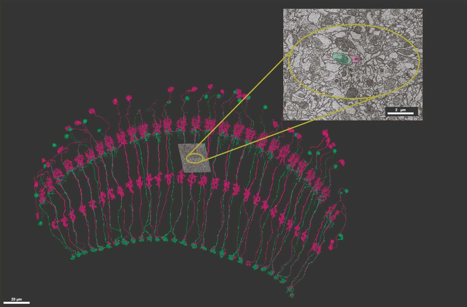 neuronal wiring diagram of an adult brain